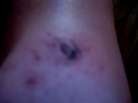 Wound exhibit #1.jpg